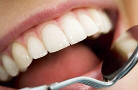 دراسة امريكية ..إهمال صحة الأسنان يسبب أمراض جسدية وعقلية